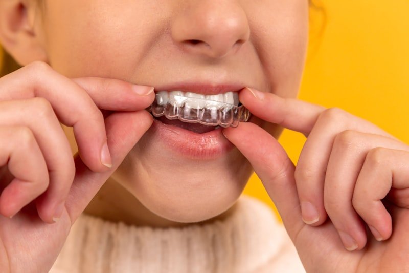 Teeth Cleaning and Scaling in Sirsa